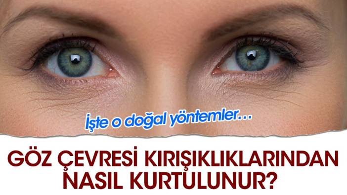 Göz çevresi kırışıklıklarından nasıl kurtulunur? İşte o doğal yöntemler…