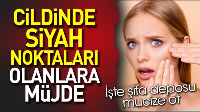 Cildinde siyah noktaları olanlara müjde. İşte şifa deposu mucize ot