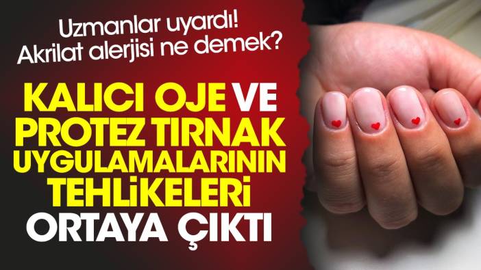 Kalıcı oje ve protez tırnak uygulamalarının tehlikeleri ortaya çıktı! Uzmanlar uyardı! Akrilat alerjisi ne demek?