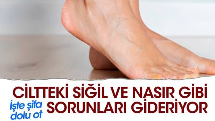 Ciltteki siğil ve nasır gibi sorunları gideriyor. İşte şifa dolu ot