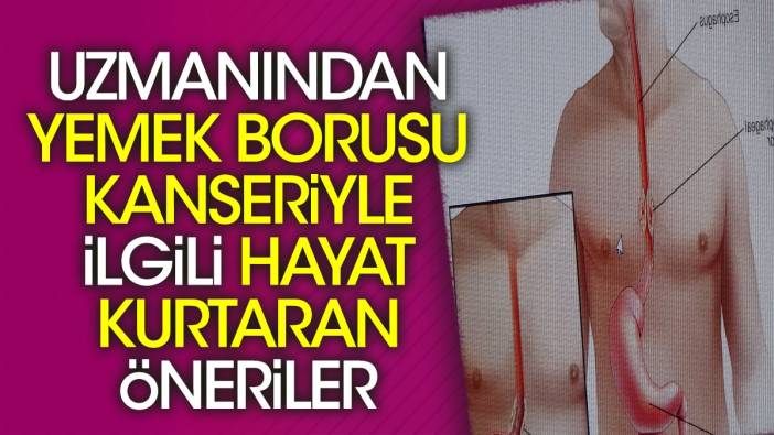 Uzmanından yemek borusu kanseriyle ilgili hayat kurtaran öneriler