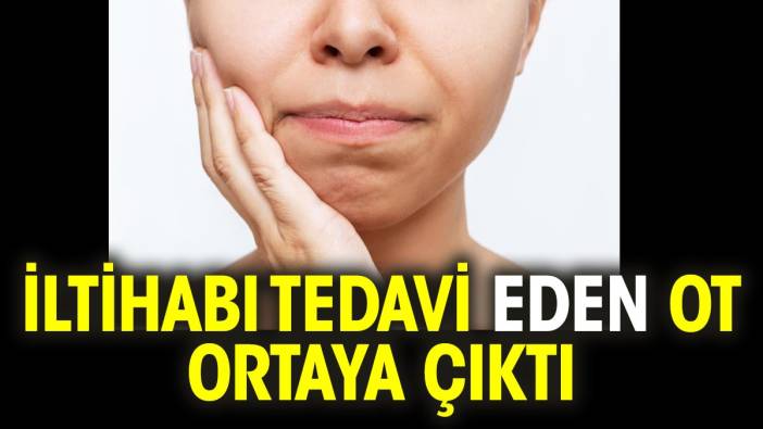 İltihabı tedavi eden ot ortaya çıktı