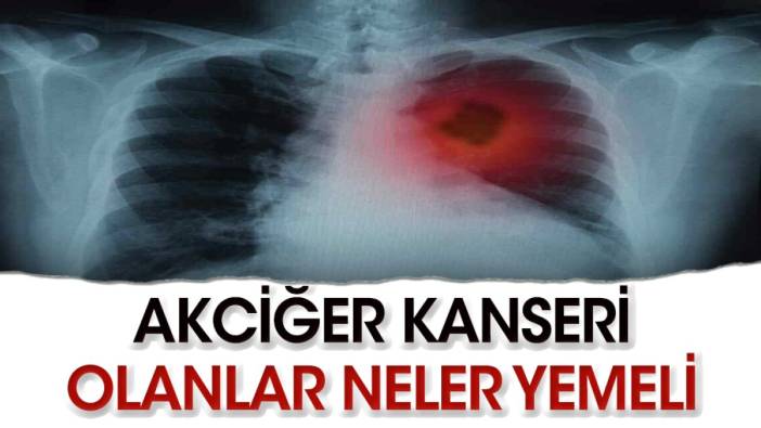 Akciğer kanseri hastaları neler yemeli