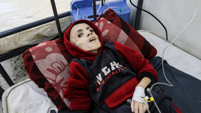 Gazzeli çocuklar açlık nedeniyle ölümle karşı karşıya
