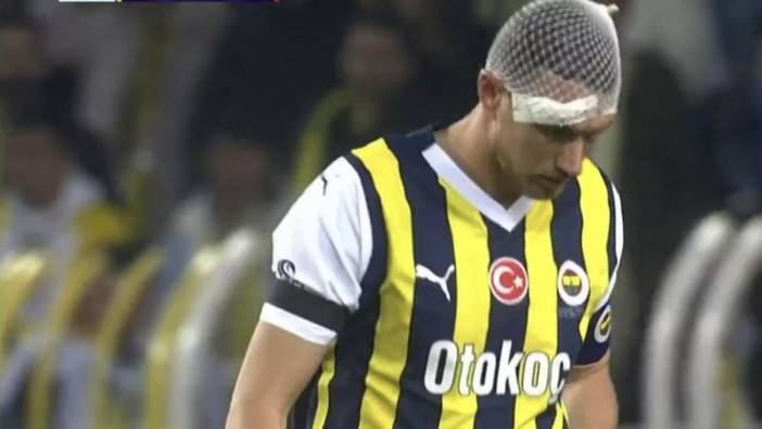 Fenerbahçe'de korkutan sakatlık. Kanlar içinde yerde kaldı.