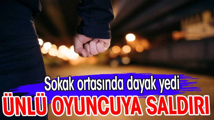 Ünlü oyuncuya saldırı. Sokak ortasında dayak yedi