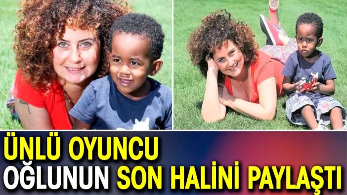 Esra Akkaya oğlunun son halini paylaştı