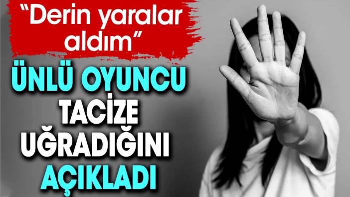 Ünlü oyuncu 'Derin yaralar aldım' diyerek tacize uğradığını açıkladı