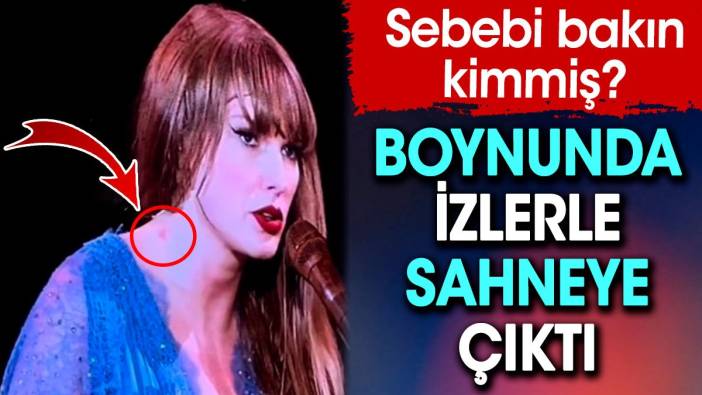 Taylor Swift’in boynundaki izlerin sebebi bakın kimmiş?