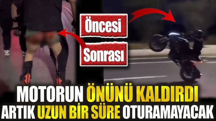 Motorun önünü kaldırdı artık uzun bir süre oturamayacak