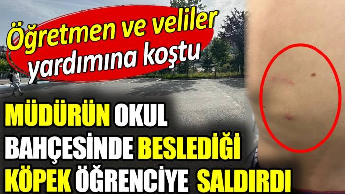 Müdürün okul bahçesinde beslediği köpek öğrenciye saldırdı. Öğretmen ve veliler yardımına koştu