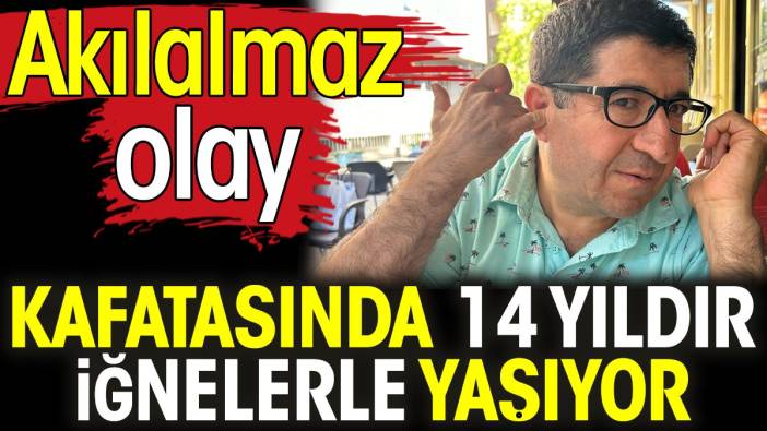 Kafatasında 14 yıldır iğnelerle yaşıyor. Akılalmaz olay