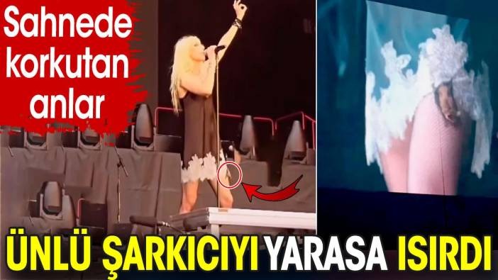 Sahnede korkutan anlar! Ünlü şarkıcıyı yarasa ısırdı