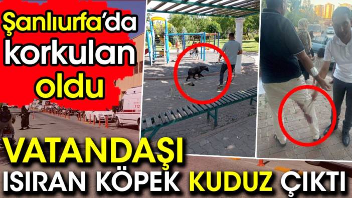 Şanlıurfa'da sokakta yürüyen bir vatandaşı ısıran köpek kuduz çıktı! Korkulan oldu