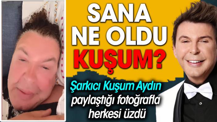 Kuşum Aydın paylaştığı fotoğrafla herkesi üzdü. Sana ne oldu kuşum?