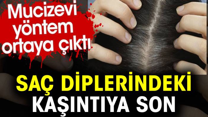 Saç diplerindeki kaşıntıya son. Mucizevi yöntem ortaya çıktı