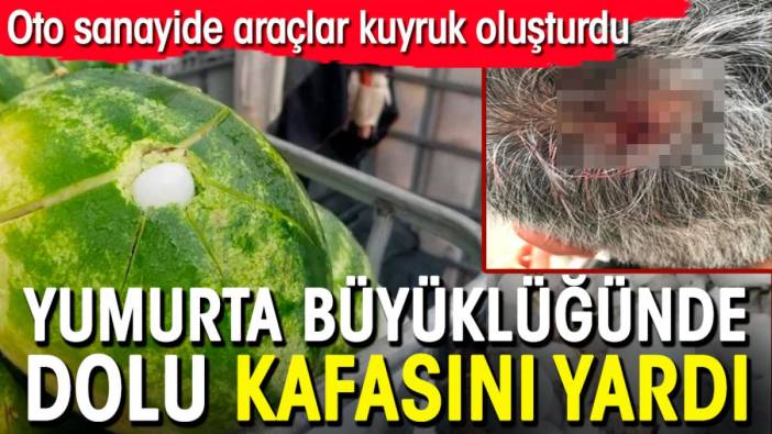 Yumurta büyüklüğündeki dolu vatandaşın kafasını yardı