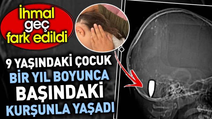 9 yaşındaki çocuk bir yıl boyunca başındaki kurşunla yaşadı. İhmal geç fark edildi