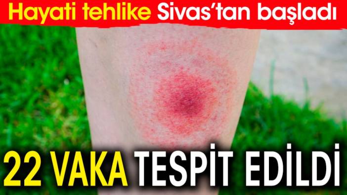 Hayati tehlike Sivas'tan başladı. 22 vaka tespit edildi