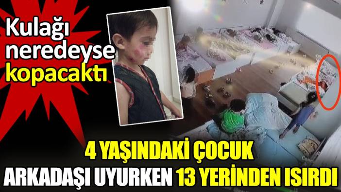 4 yaşındaki çocuk arkadaşı uyurken 13 yerinden ısırdı: Kulağı neredeyse kopacaktı