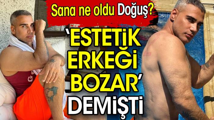 Şarkıcı Doğuş’a bir haller olmuş! ‘Estetik erkeği bozar’ demişti