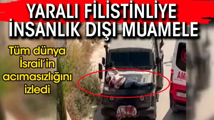 Tüm dünya İsrail'in acımasızlığını izledi. Yaralı Filistinliye insanlık dışı muamele