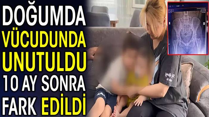 Doğumda vücudunda unutuldu 10 ay sonra fark edildi