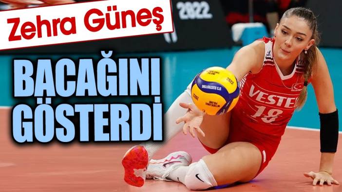 Zehra Güneş bacağını gösterdi