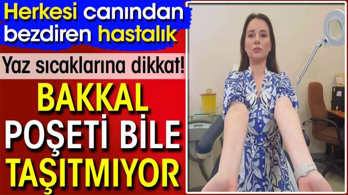 Herkesi canından bezdiren hastalık! Bakkal poşeti bile taşıtmıyor