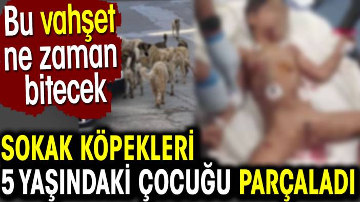 Sokak köpekleri 5 yaşındaki çocuğu parçaladı. Bu tehlike ne zaman bitecek