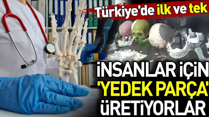 İnsanlar için 'Yedek parça' üretiyorlar. Türkiye'de ilk ve tek