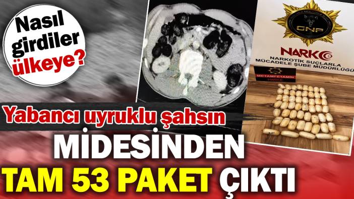 Yabancı uyruklu şahsın midesinden tam 53 paket çıktı. Nasıl girdiler ülkeye?