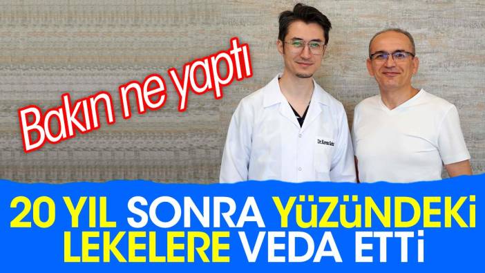 20 yıl sonra yüzündeki lekelere veda etti. Bakın ne yaptı