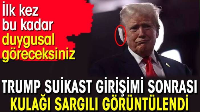 Trump suikast girişimi sonrası kulağı sargılı görüntülendi. İlk kez bu kadar duygusal göreceksiniz