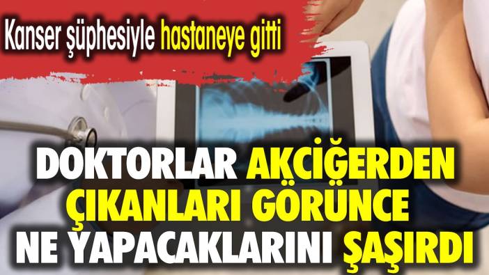 Kanser şüphesiyle hastaneye gitti. Doktorlar akciğerden çıkanları görünce ne yapacaklarını şaşırdı