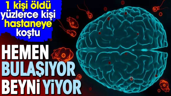 Hemen bulaşıyor beyni yiyor. 1 kişi öldü yüzlerce kişi hastaneye koştu