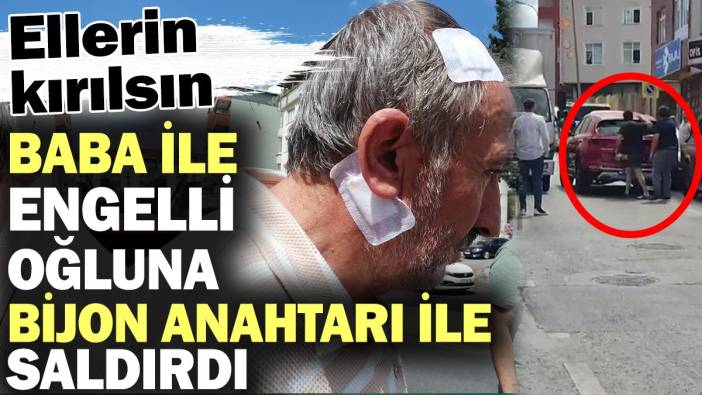 Sultanbeyli’de baba ile engelli oğluna bijon anahtarı ile saldırdı! Ellerin kırılsın