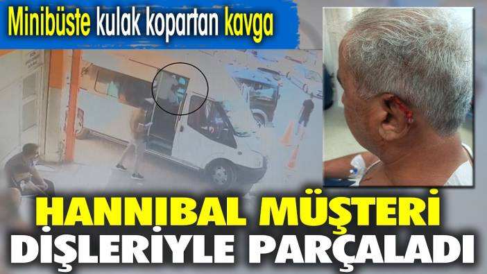 Hannibal müşteri şoförün kulağını ısırarak kopardı