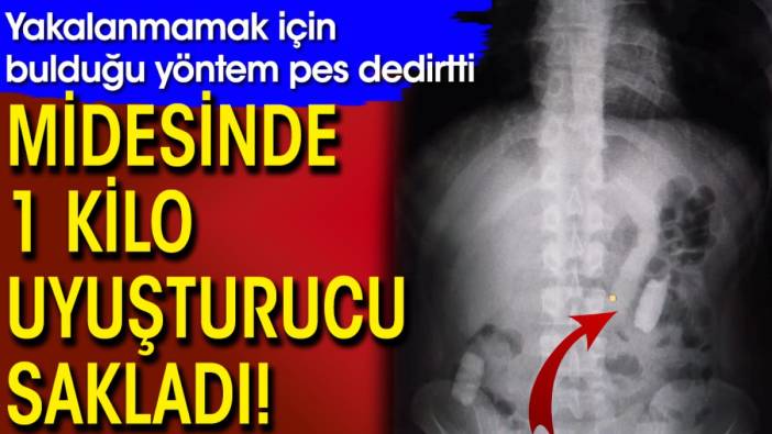 Midesinde 1 kilo uyuşturucu sakladı! Yakalanmamak için bulduğu yöntem pes dedirtti