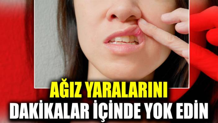 Ağız yaralarını dakikalar içinde yok edin