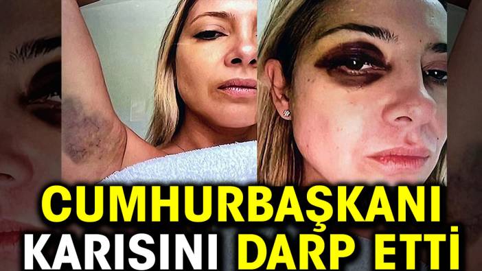 Cumhurbaşkanı karısını darp etti