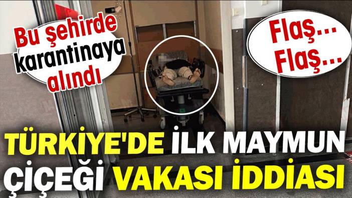 Türkiye'de ilk maymun çiçeği vakası iddiası! Bu şehirde karantinaya alındı