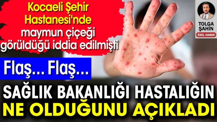 Kocaeli’nde maymun çiçeği vakası iddiası! Sağlık Bakanlığı’ndan açıklama geldi