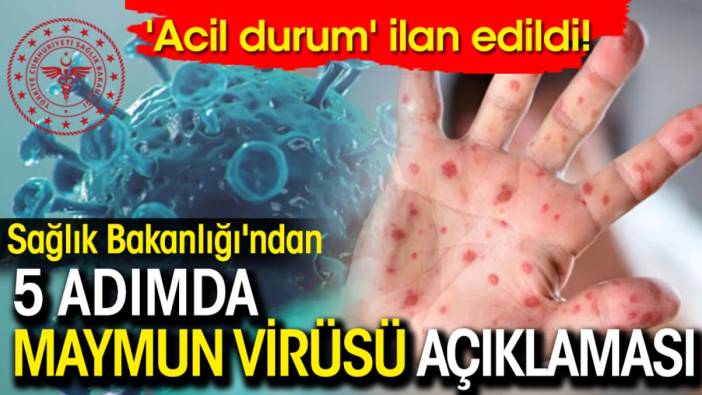 Sağlık Bakanlığı'ndan 5 adımda maymun virüsü açıklaması: 'Acil durum' olarak ilan edildi!