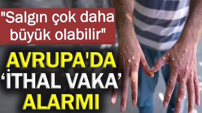 Avrupa'da ‘ithal vaka’ alarmı: Salgın çok daha büyük olabilir