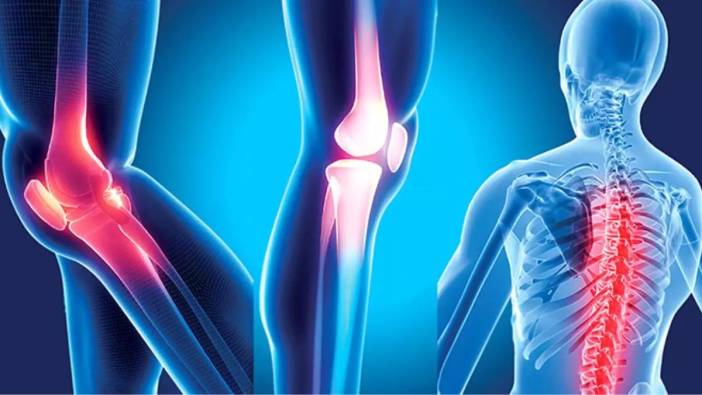 Osteoporoz: Kemiklerin sessiz düşmanı