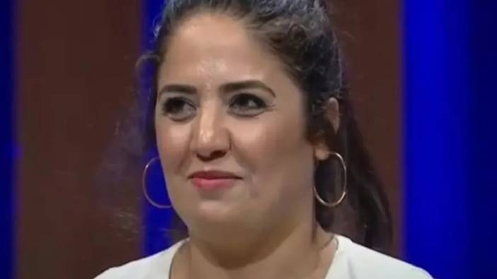 MasterChef'e damga vurmuştu! Estetiklerle bambaşka birine döndü