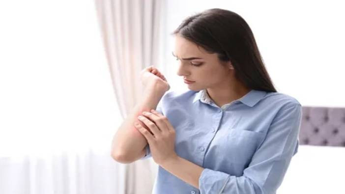 Evdeki uyuz salgınına karşı alınması gereken önlemleri uzmanlar açıkladı