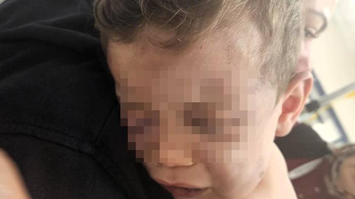 Vahşeti yaşayan 2 yaşındaki bebek hastanelik oldu