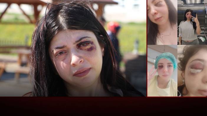 Sokak ortasında darp edilmişti! Damla olaydan sonra acı gerçeği açıkladı...